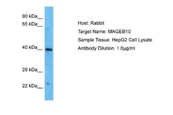 MAGEB10 Rabbit anti-Human, Polyclonal, Novus Biologicals 0.1 mL | Buy Online | Novus Biologicals | Fisher Scientific